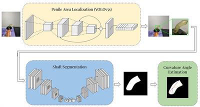 Automated quantification of penile curvature using artificial intelligence